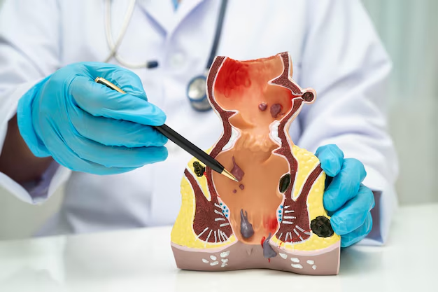 Modern Relief Options for Better Comfort with Non Surgical Hemorrhoid Treatment